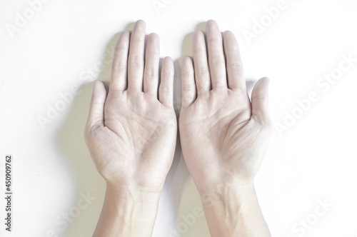 Pale palmar surface of hands. Anaemic hands of Asian man.