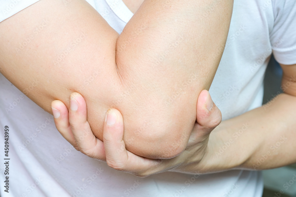 Men use their hands to hold their elbows and He had pain at the elbows.. Painful Health and medical concepts Men use their hands to hold their elbows and He had pain at the elbows.. Painful Health and medical concepts