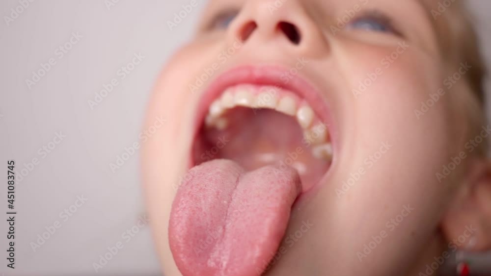 girl opens her mouth wide and pulls out long tongue. child shows his teeth and mouth to dentist. mouth is wide open, tongue is stuck out as far as possible, with clear view of tongue and soft palate Stock-Video          