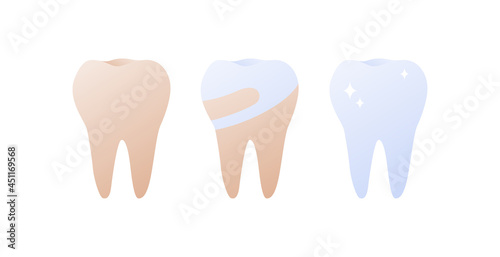 Tooth whitening, cleaning and stomatology concept. Vector flat healthcare illustration. Stages from yellow to clean white teeth. Design for dentistry