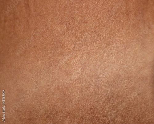 contrast of tanned and fair skin as background