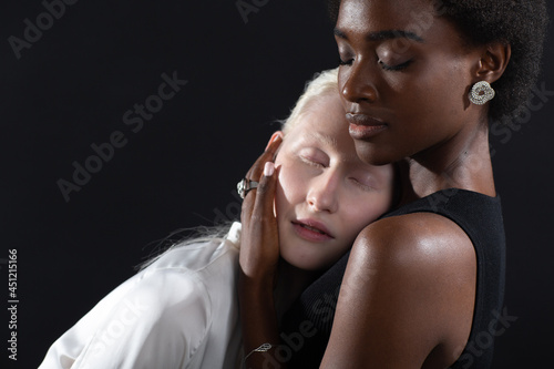 Caucasian albino girl and african american young woman hugging on black background. Women friendship day, love and relationships. Friendships concept.