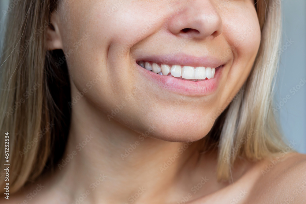 Cropped shot of a face of a young caucasian smiling blonde woman with dimples on her cheeks. Close-up of a blonde girl with even white teeth. Dentistry - obrazy, fototapety, plakaty 