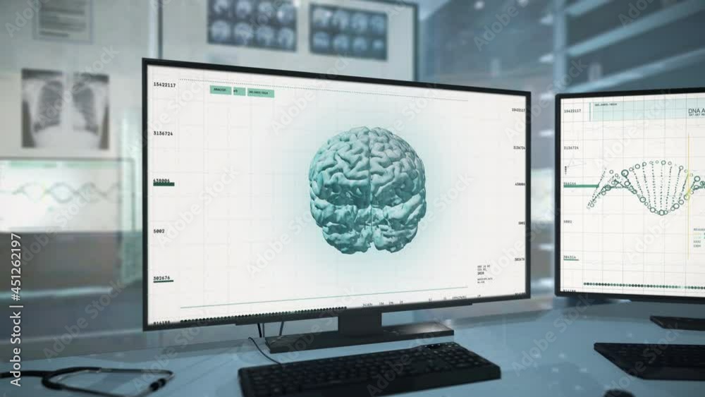 Medical Computer Diagnostic System Discovers Brain Tumor During