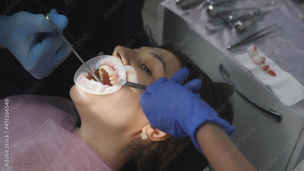 The dentist and an assistant suture the damaged place in the patient's mouth after removing the wisdom tooth. The dentist and an assistant suture the damaged place in the patient's mouth after removing the wisdom tooth.
