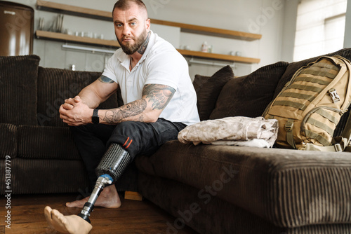 Mid aged white man with prosthetic leg