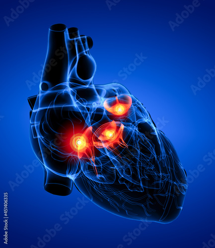 3d render Heart valve