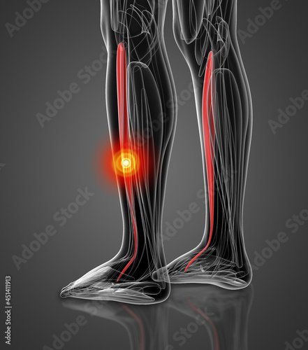 medical  illustration of the tibialis anterior