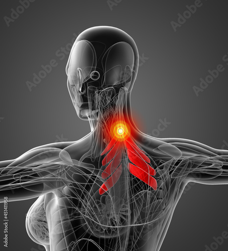 medical  illustration of the serratus posterior superior photo