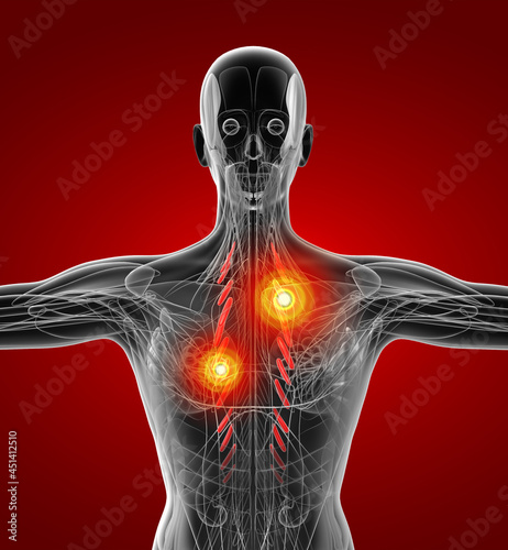 medical  illustration of the Levator Costarum photo