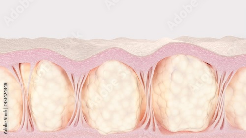 Cellulite treatment. Medical 3d animation showing regeneration process of adipose cells in skin tissues