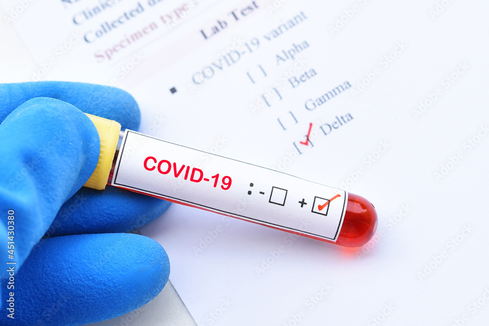 Obraz premium Delta variant COVID-19 positive, blood sample tube positive with delta variant or Indian strain COVID-19 