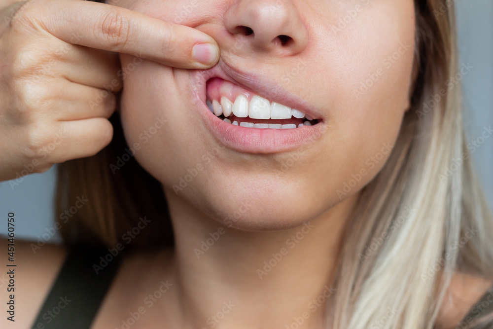 Gum health. Close-up of a young woman showing healthy gums. Dentistry, dental care Gum health. Close-up of a young woman showing healthy gums. Dentistry, dental care
