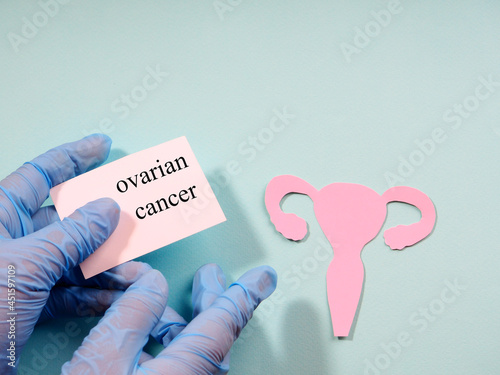 A hand in a medical glove holds a sign with the inscription ovarian cancer on the background of the silhouette of the ovarian