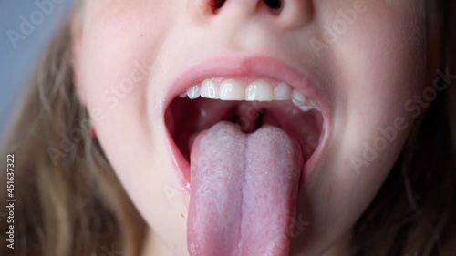 girl opens her mouth wide and pulls out long tongue. child shows his teeth soft palate and mouth to dentist. mouth is wide open, tongue is stuck out as far as possible, with clear view of tongue photo