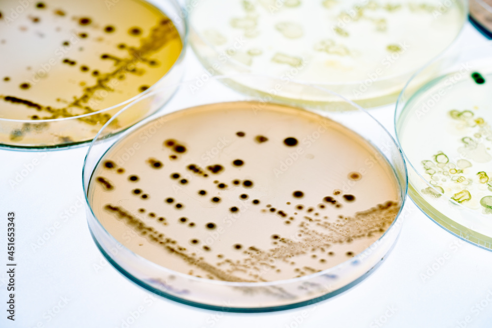 Mixed of bacteria colonies and fungus in various petri dish Mixed of bacteria colonies and fungus in various petri dish