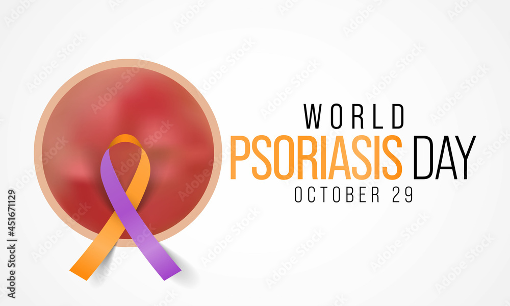 World Psoriasis day is observed every year on October 29, it is a skin condition that causes red, flaky, crusty patches of skin covered with silvery scales. Vector illustration World Psoriasis day is observed every year on October 29, it is a skin condition that causes red, flaky, crusty patches of skin covered with silvery scales. Vector illustration