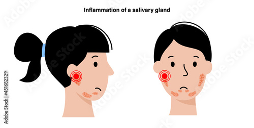Salivary gland concept