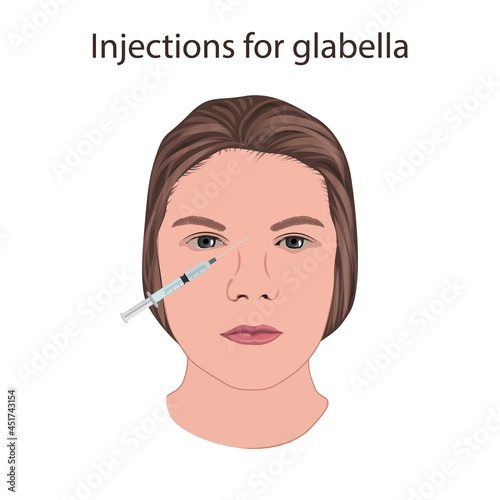 Injections for glabella, illustration photo