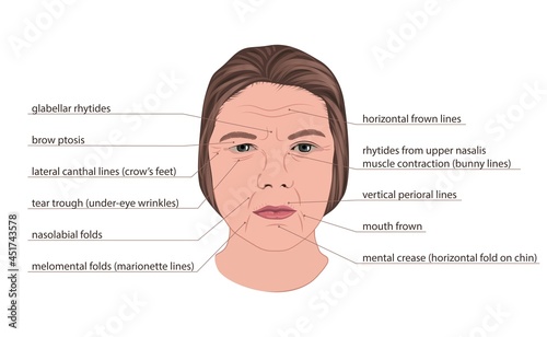 Facial wrinkles, illustration photo