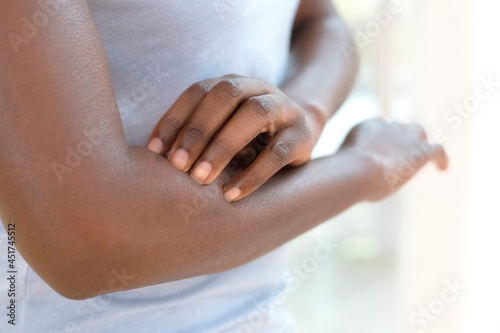 Woman scratching her arm photo