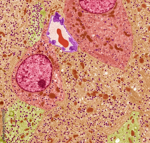 Pancreatic islet cells, TEM photo