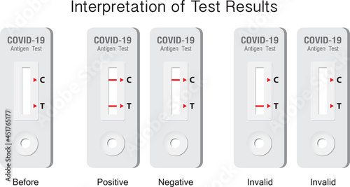 Interpretation of Covid-19 antigen test results. The infographic chart explains the reading of the results from the antigen test kit. photo