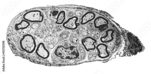 Peripheral nerve, TEM photo