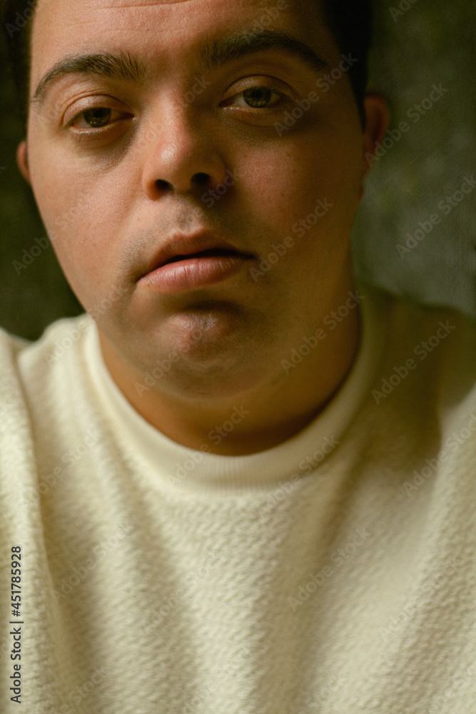 Closeup portrait of young man with Down Syndrome looking into the camera Closeup portrait of young man with Down Syndrome looking into the camera