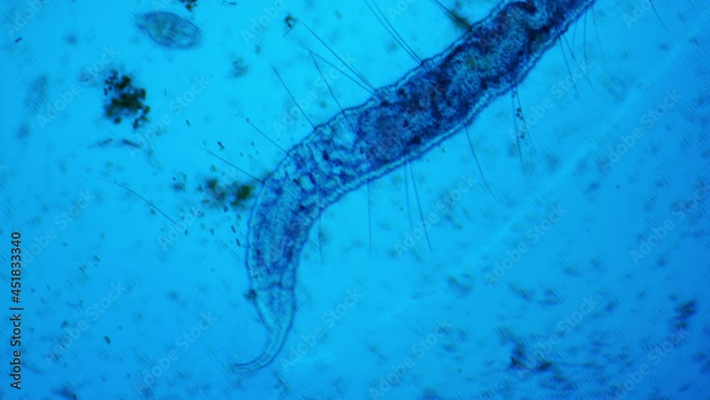 Predatory aquatic worm under a microscope. It is surrounded by bacteria, rotifer colony, algae. Observation of wildlife. Satisfying curiosity. Predatory aquatic worm under a microscope. It is surrounded by bacteria, rotifer colony, algae. Observation of wildlife. Satisfying curiosity.