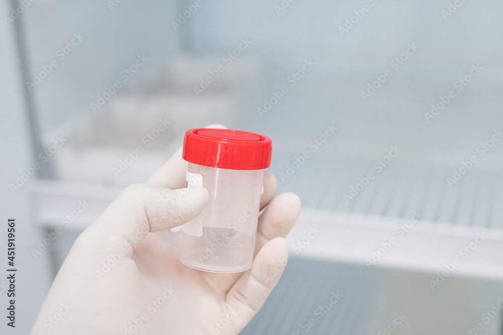 Close up scientist hand opening storage reagent container for laboratory analysis.Scientist hand holding reagent tube during prepare specimen for auto machine analysis.Laboratory medical analysis.