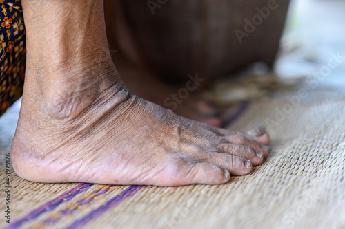 withered feet of old woman, withered tan skin, healthy and long live concept