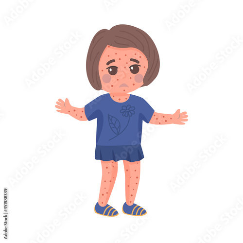 Little girl having chickenpox clipart. Isolated on white background vector illustration. Brown haired character in blue dress suffering from childhood disease.