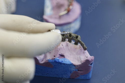 dental implant