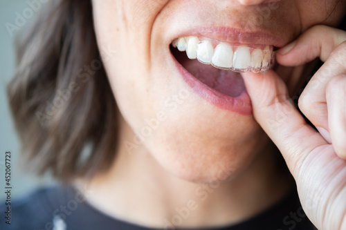 Beautiful smile and white teeth of a young woman