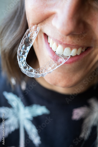 Beautiful smile and white teeth of a young woman