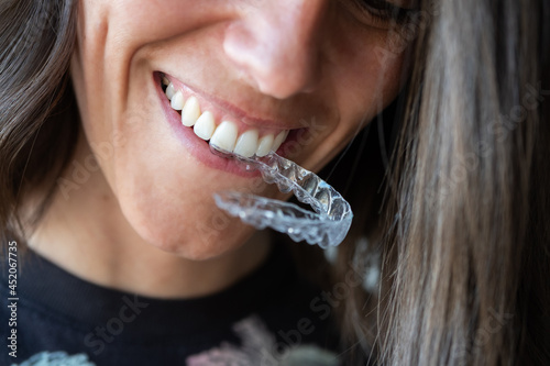Beautiful smile and white teeth of a young woman
