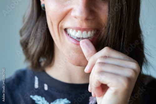 Beautiful smile and white teeth of a young woman photo