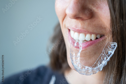 Beautiful smile and white teeth of a young woman