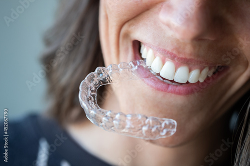 Beautiful smile and white teeth of a young woman