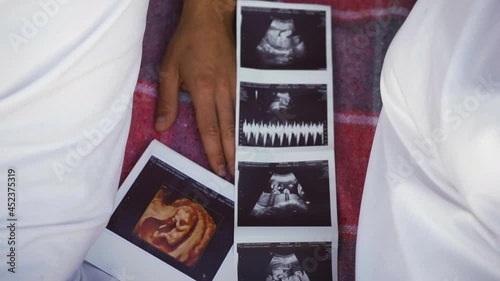 Husband and wife lying on the bedspread and between them an ultrasound image of the baby, the fetus. Parents expecting a newborn and being examined did a scan of the woman's abdomen photo