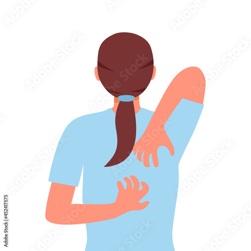 Young woman suffering from itchy skin in flat design on white background. Female  scratching her back. Allergic skin problem.