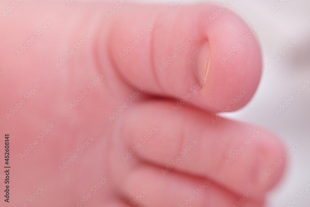 Toes on the foot of a newborn baby, close-up. Macro photo of a healthy toe of a child Toes on the foot of a newborn baby, close-up. Macro photo of a healthy toe of a child