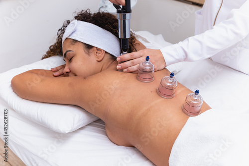 Woman lying on her chest with cupping treatment on her back. woman doing sucker photo