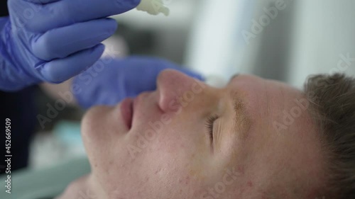 Doctor uses eye drops for patient's eyes before laser vision correction.