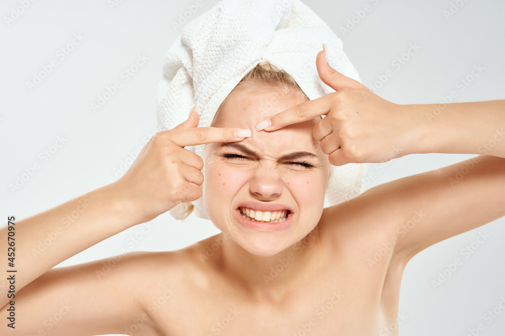 woman with bare shoulders squeezes out pimples on the face dermatology acne woman with bare shoulders squeezes out pimples on the face dermatology acne