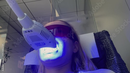 Woman getting her teeth whitened at the dental clinic photo
