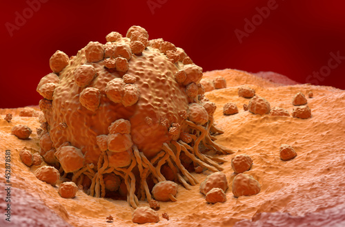 Melanoma cell a type of skin cancer closeup view 3d illustration photo