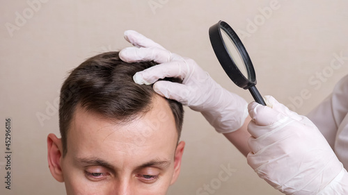 medical professional with gloves and a magnifying glass examines the head of a young man closeu.