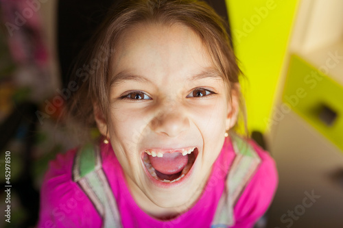 A small beautiful girl without front baby teeth looks at the camera in close-up and smiles and shouts.
